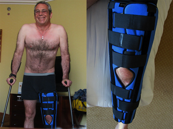 watt w/knee immobilizer + crutches in lyon france - july 13, 2010